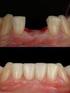 MULTY SYSTEM. Catalogo Implantoprotesico SEZIONE 3. Impianti Monofasici. dental implant