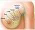 Patologia molecolare del carcinoma della mammella: cosa un patologo deve sapere. Vicenza 20 marzo 2014 Dott. Duilio Della Libera