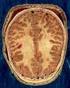 La corteccia cerebrale umana è un grande mantello grigio con estesa superficie