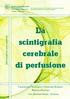 La Informazione per pazienti. scintigrafia cerebrale di perfusione. Dipartimento Oncologico e Tecnologie Avanzate Medicina Nucleare