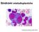Sindromi mielodisplastiche. Castoldi G. Atlas of blood cells. 2003; p