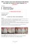 PDF 2. Estetica conservativa direttamente alla poltrona allo studio con restauri in resina composita (non protesica). A. Sbiancamento dei denti